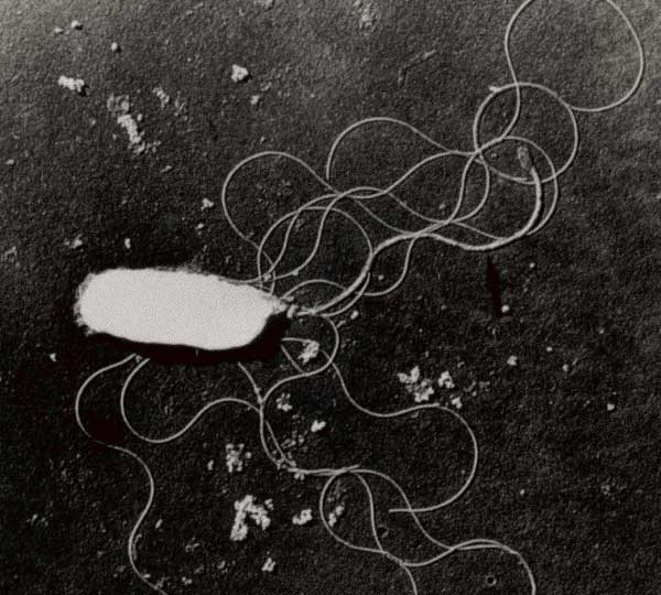 Vi khuẩn Vibrio parahaemolyticus là gì, có tiêu diệt được không?